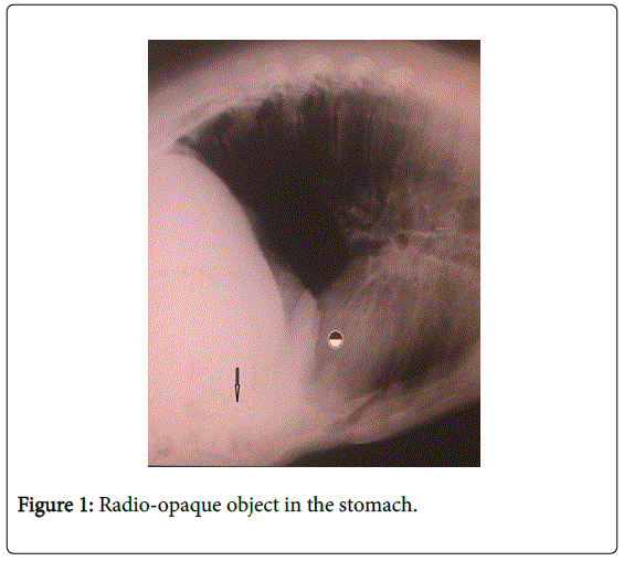 gastrointestinal-digestive-Radio-opaque-object