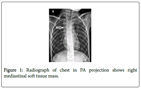 gastrointestinal-digestive-Radiograph-chest