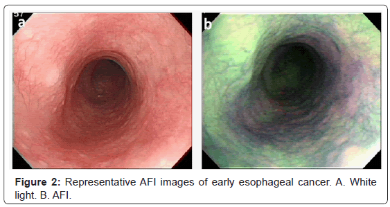gastrointestinal-digestive-Representative-AFI-images