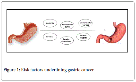gastrointestinal-digestive-Risk-factors