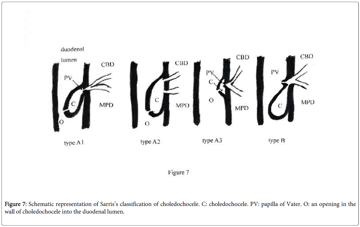 gastrointestinal-digestive-Schematic-representation