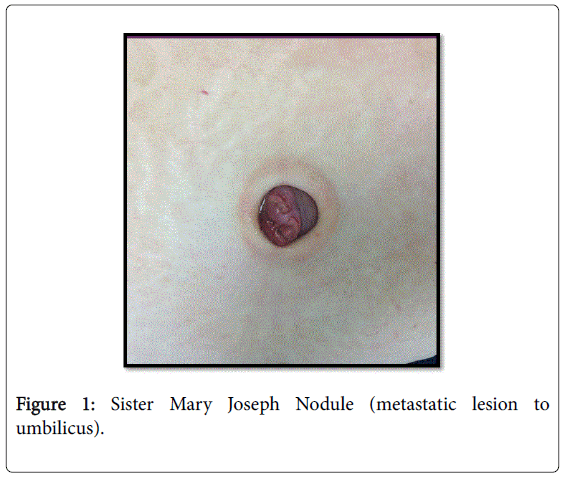 gastrointestinal-digestive-Sister-Mary-Joseph