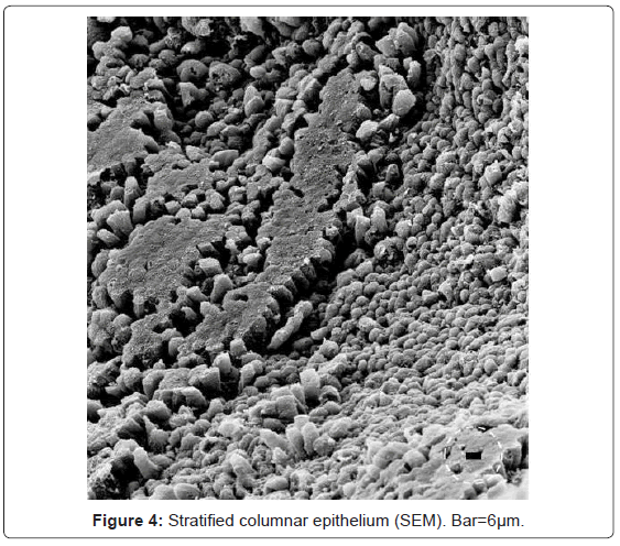 gastrointestinal-digestive-Stratified-columnar