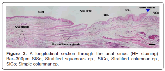 gastrointestinal-digestive-Stratified-squamous-ep