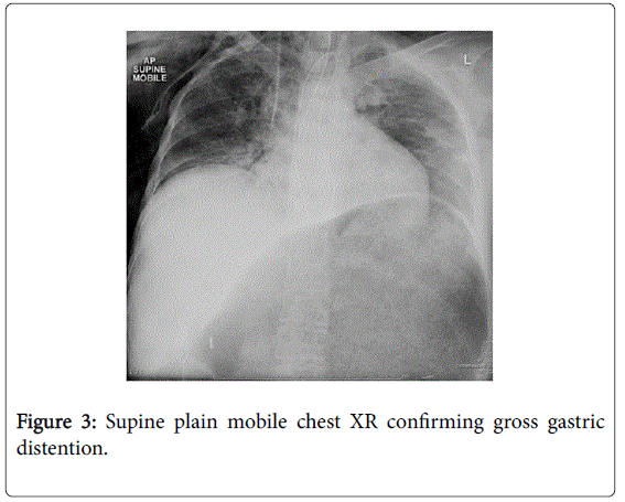 gastrointestinal-digestive-Supine-plain-mobile
