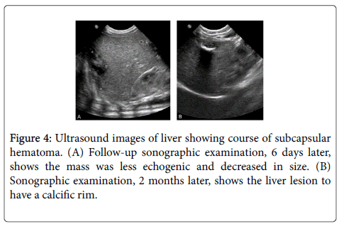 gastrointestinal-digestive-Ultrasound-images