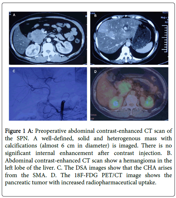 gastrointestinal-digestive-abdominal-contrast-enhanced