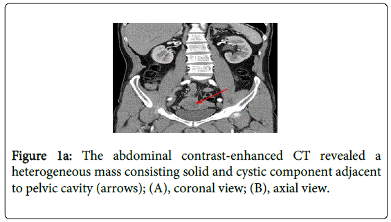 gastrointestinal-digestive-abdominal-contrast-enhanced