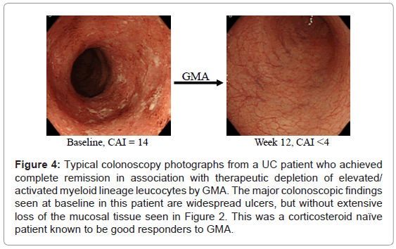 gastrointestinal-digestive-activated-myeloid-lineage