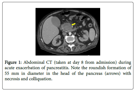 gastrointestinal-digestive-acute-exacerbation-pancreatitis