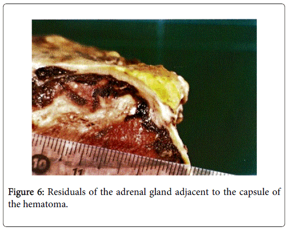 gastrointestinal-digestive-adrenal-gland-adjacent