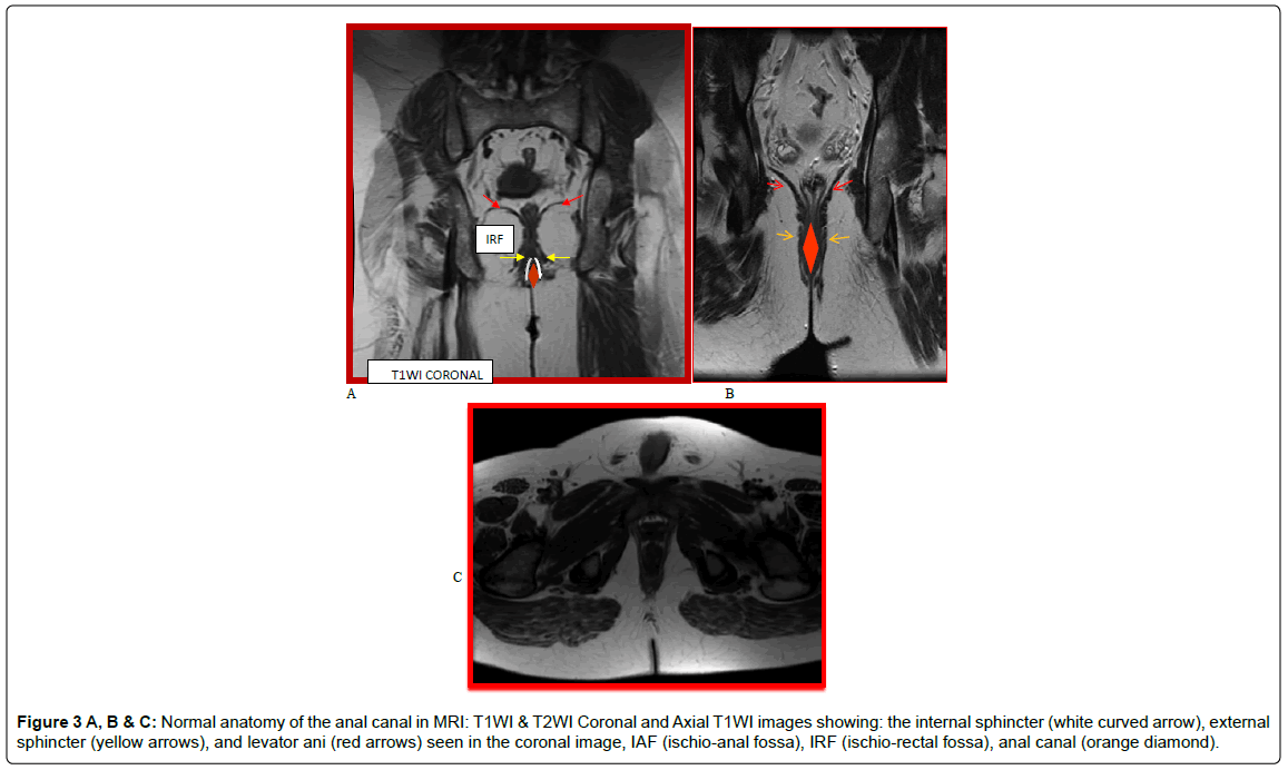 gastrointestinal-digestive-anatomy-anal-canal-MRI