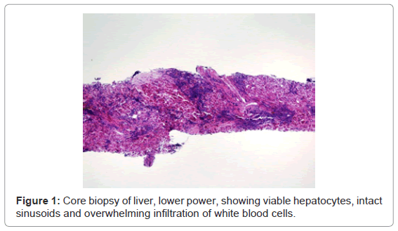 gastrointestinal-digestive-biopsy-liver-lower-power