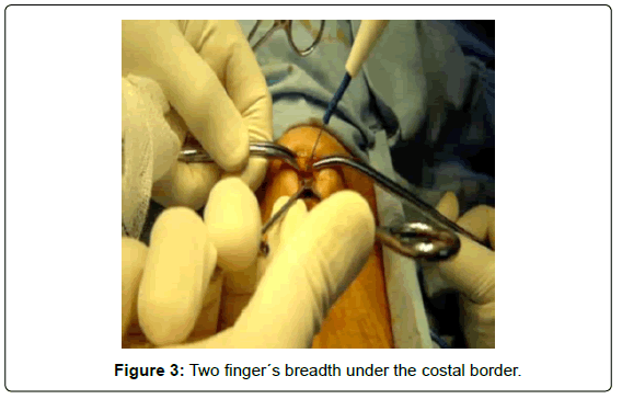 gastrointestinal-digestive-breadth-under-costal-border