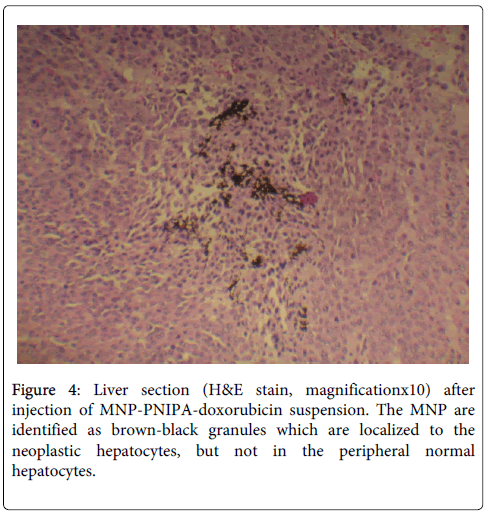 gastrointestinal-digestive-brown-black