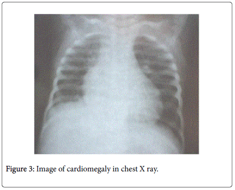 gastrointestinal-digestive-chest-X-ray