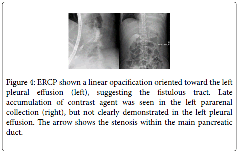 gastrointestinal-digestive-clearly-demonstrated