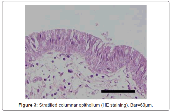 gastrointestinal-digestive-columnar-epithelium