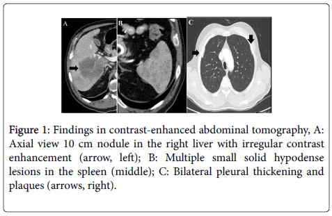 gastrointestinal-digestive-contrast-enhanced