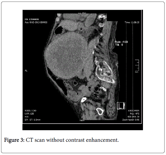 gastrointestinal-digestive-contrast-enhancement