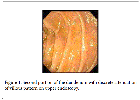 gastrointestinal-digestive-discrete-attenuation