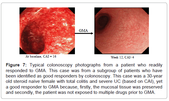gastrointestinal-digestive-exposed-multiple-drugs