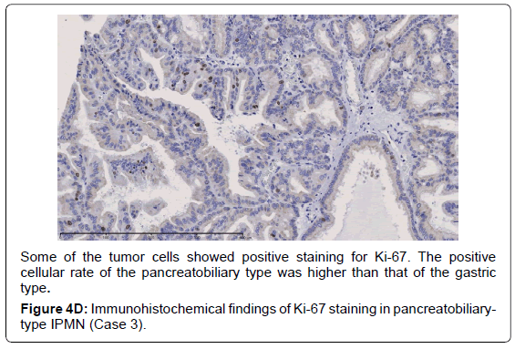 gastrointestinal-digestive-findings-Ki-67-staining