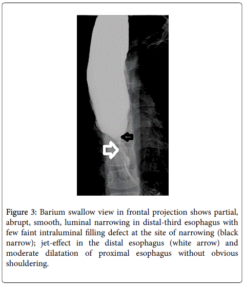 gastrointestinal-digestive-frontal-projection