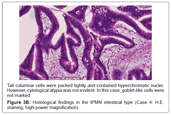 gastrointestinal-digestive-goblet-like-cells