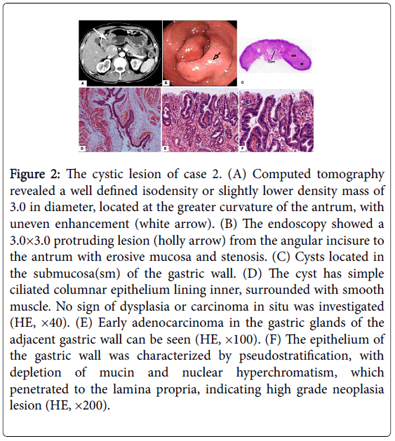gastrointestinal-digestive-greater-curvature-antrum