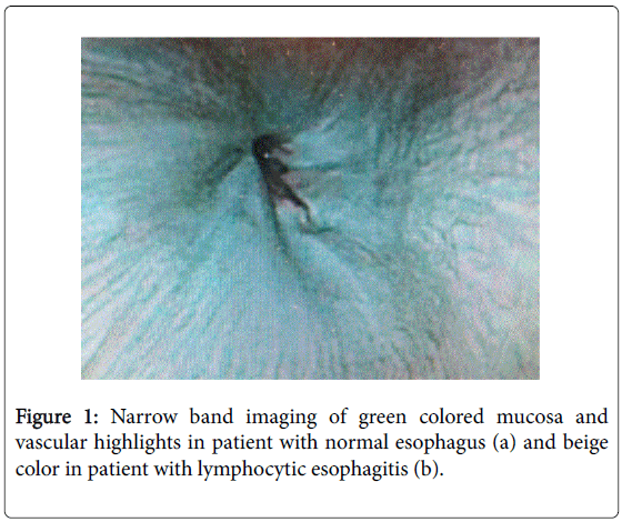 gastrointestinal-digestive-green-colored-mucosa