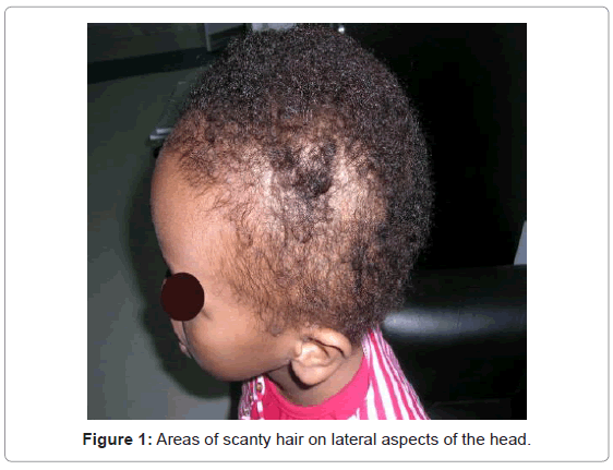 gastrointestinal-digestive-hair-lateral-aspects