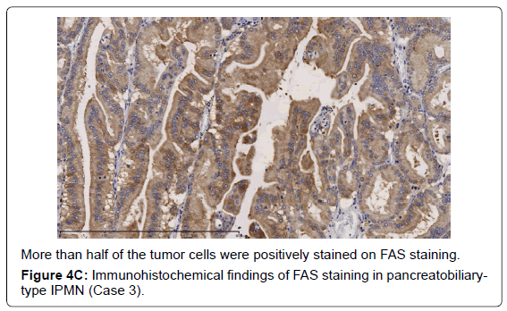 gastrointestinal-digestive-half-tumor-cells