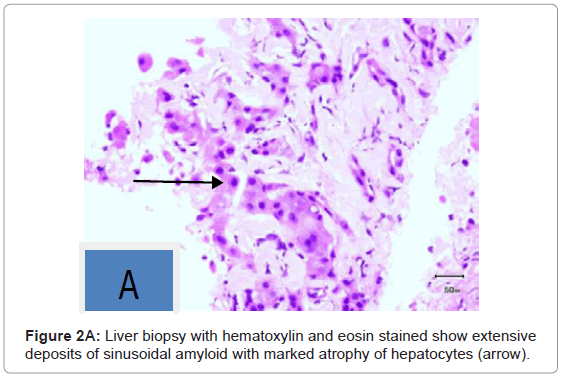 gastrointestinal-digestive-hematoxylin-eosin-stained