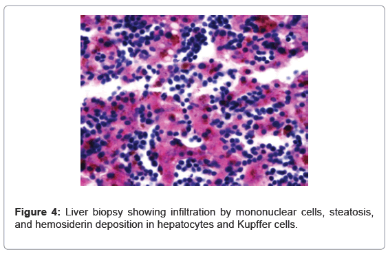 gastrointestinal-digestive-hepatocytes-Kupffer-cells