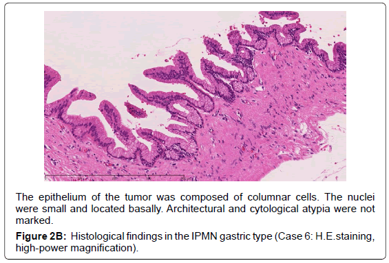 gastrointestinal-digestive-high-power-magnification