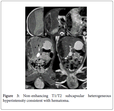 gastrointestinal-digestive-hyperintensity-consistent