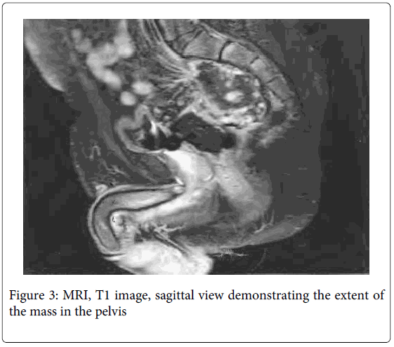 gastrointestinal-digestive-image-sagittal-view