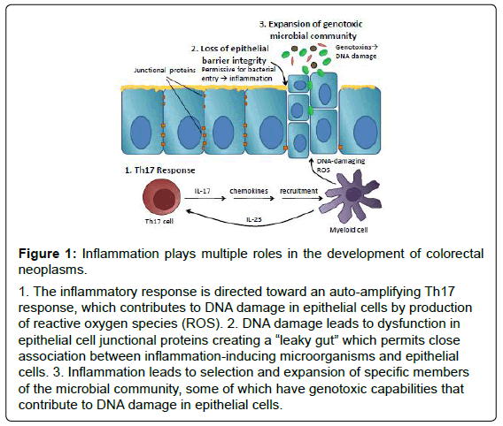 gastrointestinal-digestive-inflammatory-response