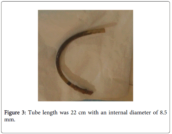 gastrointestinal-digestive-internal-diameter