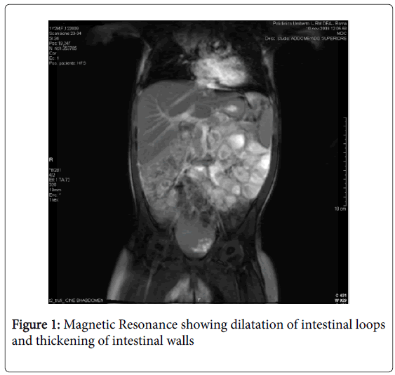 gastrointestinal-digestive-intestinal-loops