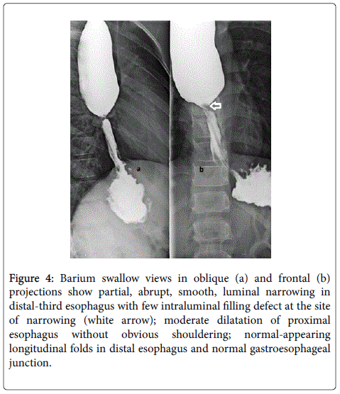 gastrointestinal-digestive-intraluminal-filling