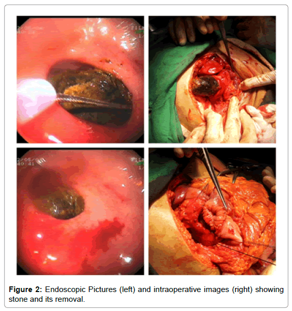 gastrointestinal-digestive-intraoperative-images