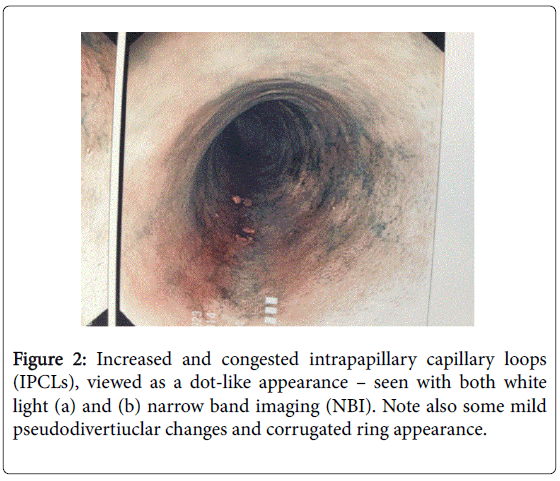 gastrointestinal-digestive-intrapapillary-capillary-loops