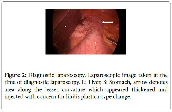 gastrointestinal-digestive-laparoscopy-Laparoscopic-image