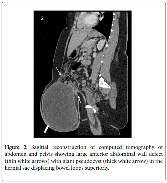 gastrointestinal-digestive-large-anterior-abdominal
