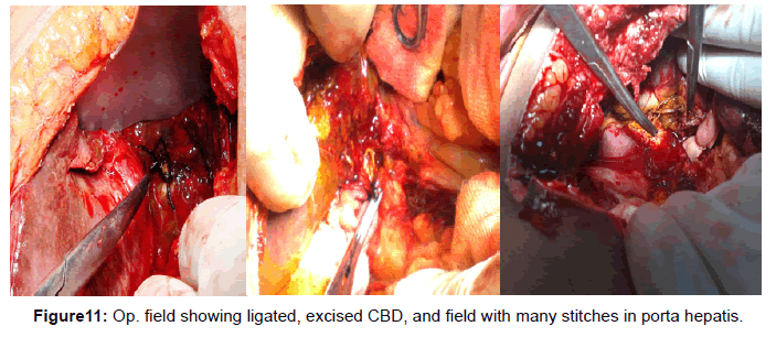 gastrointestinal-digestive-ligated-excised-CBD