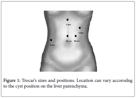 gastrointestinal-digestive-liver-parenchyma