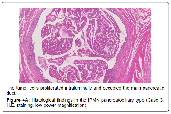 gastrointestinal-digestive-low-power-magnification