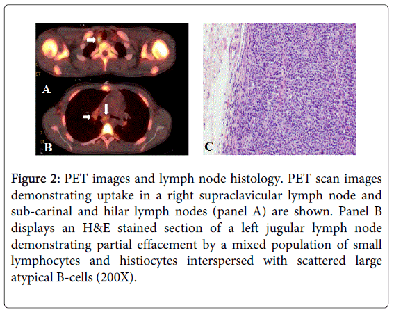 gastrointestinal-digestive-lymph-node-histology
